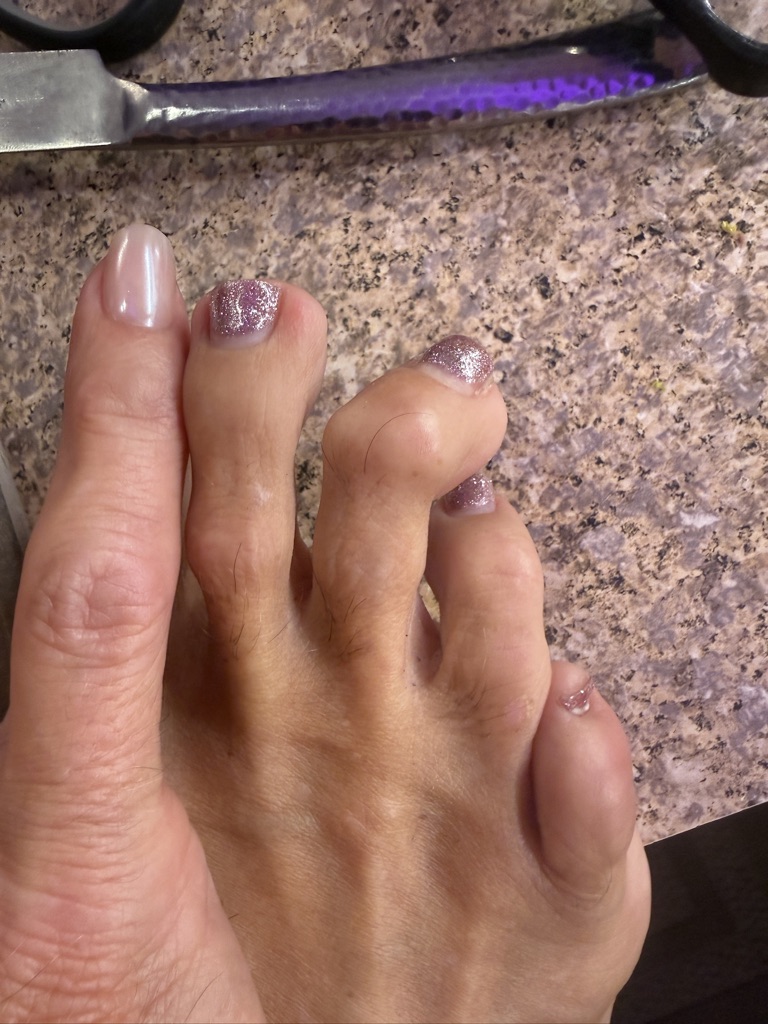 Hand holding toes with scissors on counter